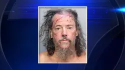 Man accused of hitting 82-year-old with tequila bottle screamed he was ‘going to kill the lesbians, gays,’ caregiver says